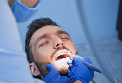 man undergoing oral surgery in Denver, CO